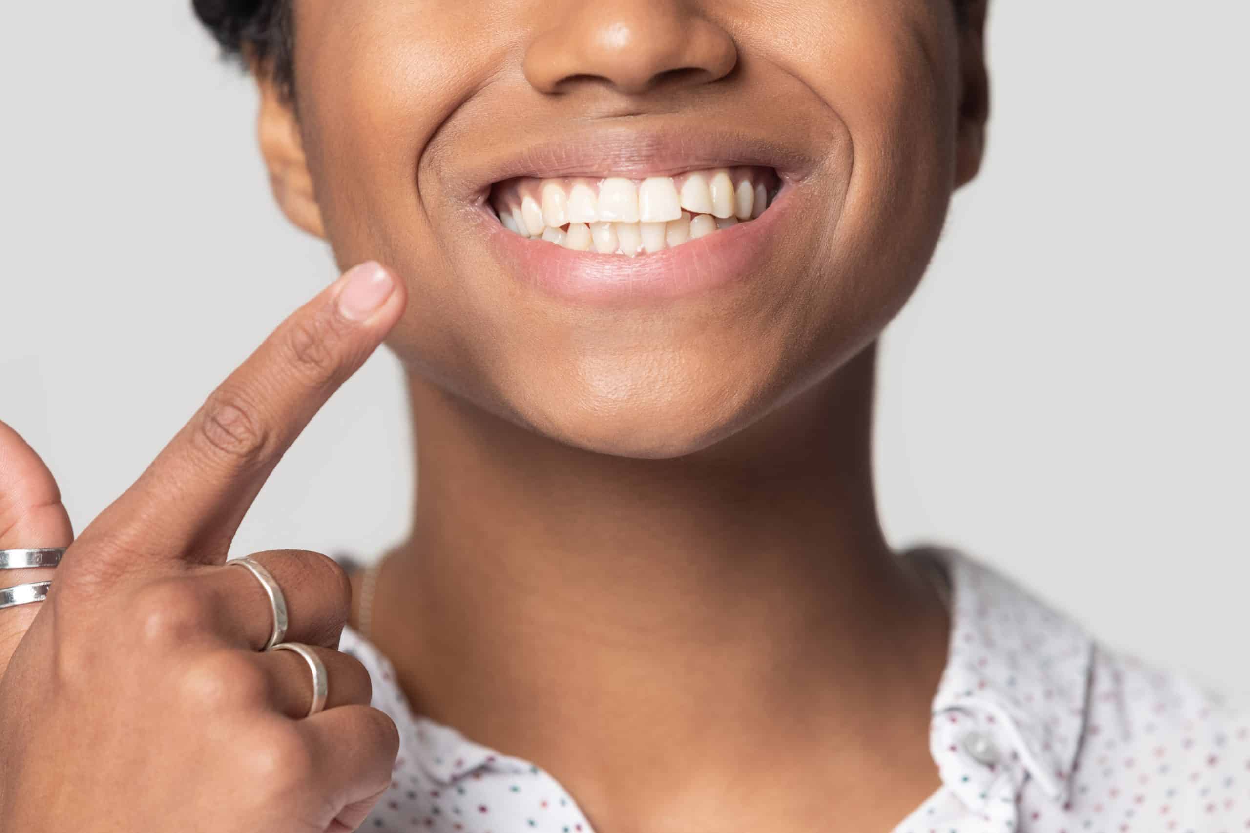 teeth whitening aurora co Teeth Whitening is an Important Part of Oral Health Care Dr. Rankin and Dr. Mingle Aurora Co