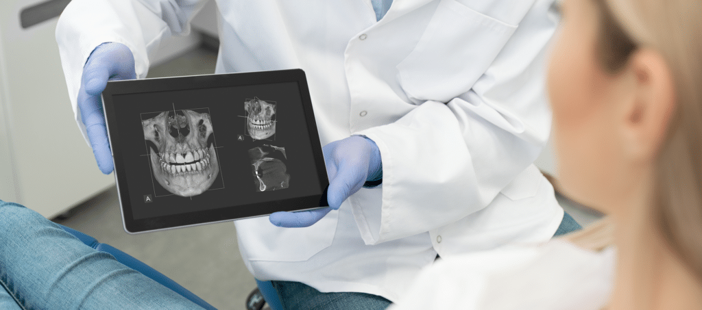Digital X-Ray