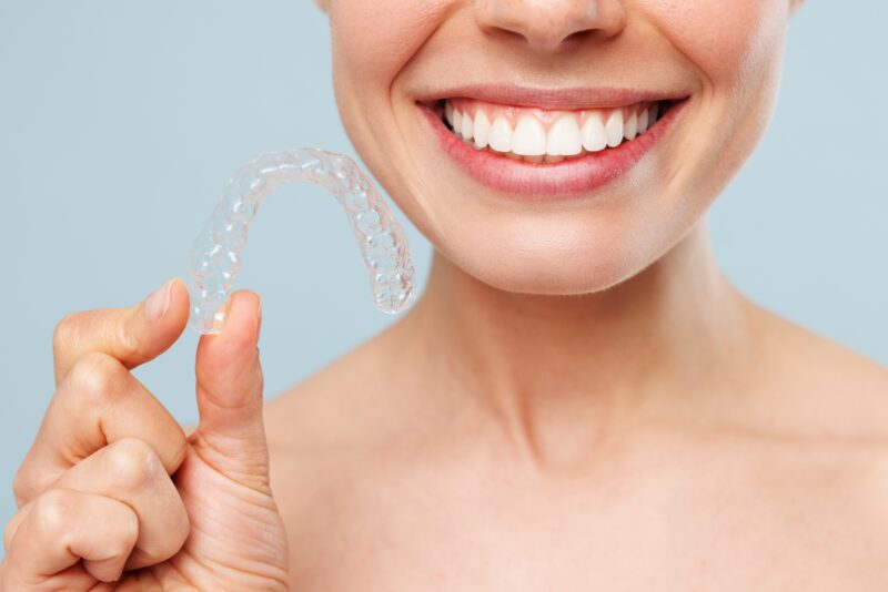clear aligners aurora
